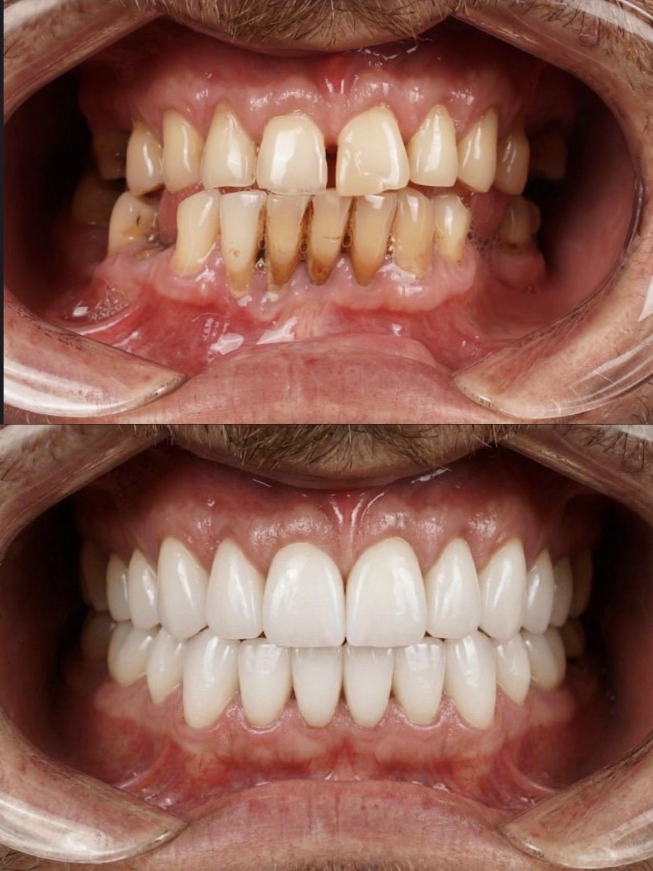 Hasta gülüş dönüşümü 27