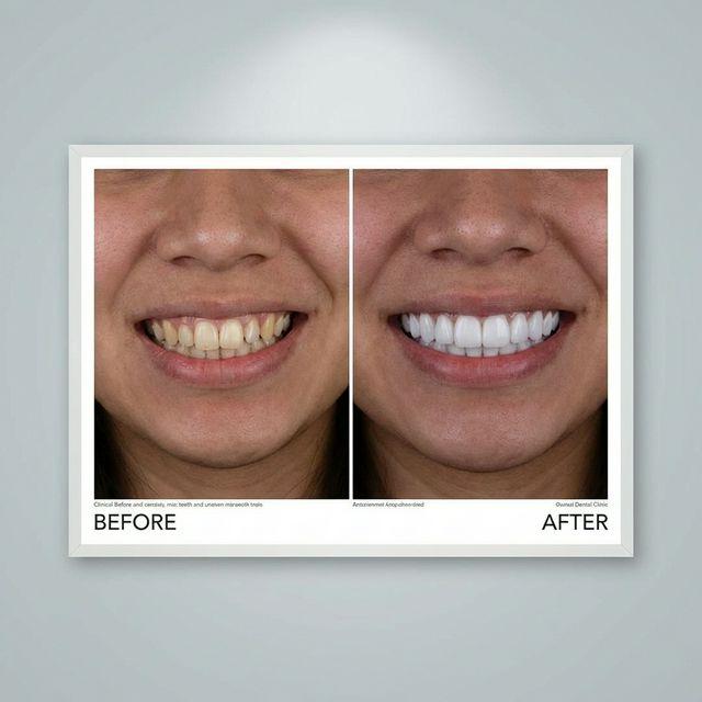 Tasarladığımız Yeni Gülüşler