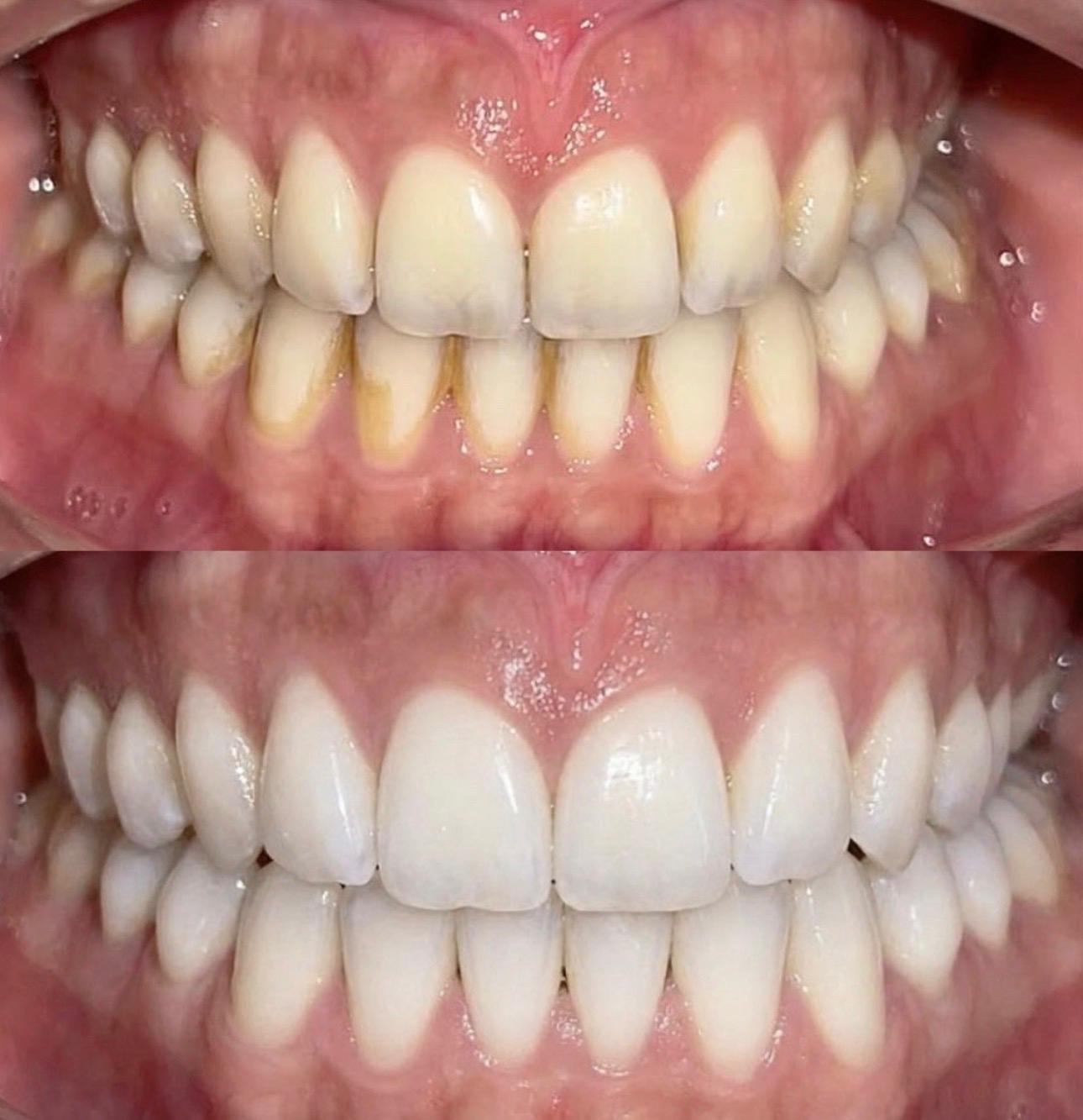 Yer Tutucu Pratikleri